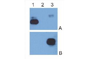 IgG κ light chain (1), IgG λ light chain (2) and IgG Fc fragment (3) purified from human serum were analysed by Western blotting with MEM-09 antibody against IgG κ light chain (A) and EM-07 antibody against IgG Fc fragment (B). (Souris anti-Humain IgG Fc (Fc Region) Anticorps)