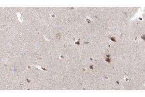 anti-RPGRIP1-Like (RPGRIP1L) (N-Term) antibody