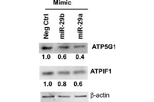 miR-29-b-1/a downregulate ATP5G1 and ATPIF1 protein expression in LCC9 breast cancer cells. (ATP5G1 anticorps  (Center))