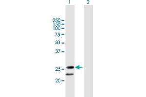 Western Blot analysis of C20orf71 expression in transfected 293T cell line by C20orf71 MaxPab polyclonal antibody. (BPIFA3 anticorps  (AA 1-218))