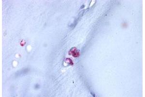 Immunohistochemistry (Formalin/PFA-fixed paraffin-embedded sections) of human cartilage tissue with ACAN polyclonal antibody . (Aggrecan anticorps  (C-Term))