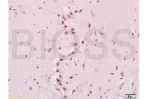 Formalin-fixed and paraffin embedded rat brain tissue labeled with Anti-NIS Polyclonal Antibody, Unconjugated (ABIN668751) at 1:200, followed by conjugation to the secondary antibody and DAB staining (SLC5A5 anticorps  (AA 525-618))