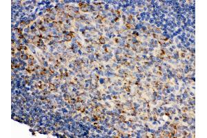 Immunohistochemistry (Paraffin-embedded Sections) (IHC (p)) image for anti-CD19 Molecule (CD19) (AA 307-337), (Middle Region) antibody (ABIN3043389) (CD19 anticorps  (Middle Region))