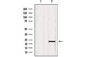 Western blot analysis of extracts from Mouse brain, using RBBP9 Antibody. (RBBP9 anticorps  (Internal Region))