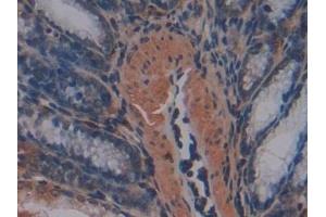 Detection of MMP7 in Mouse Small intestine Tissue using Polyclonal Antibody to Matrix Metalloproteinase 7 (MMP7)