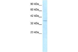 WB Suggested Anti-NLRC4 Antibody Titration: 0. (NLRC4 anticorps  (C-Term))