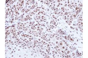 IHC-P Image Immunohistochemical analysis of paraffin-embedded Cal27 xenograft , using PRPF39, antibody at 1:500 dilution.