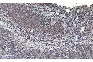IHC analysis of HDAC5 using anti-HDAC5 antibody (ABIN7599922). (HDAC5 anticorps  (AA 13-1107))