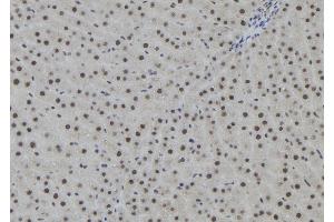 ABIN6259825 and ABIN6273090 at 1/100 staining Rat liver tissue by IHC-P.