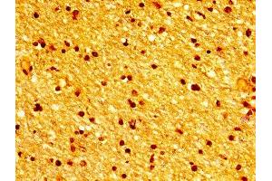 anti-Tubulin, beta 3 (TUBB3) (AA 1-210) antibody