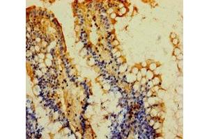 Immunohistochemistry of paraffin-embedded human small intestine tissue using ABIN7142138 at dilution of 1:100 (MOGAT2 anticorps  (AA 124-284))