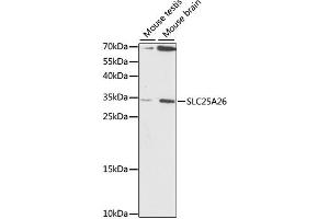 Western blot analysis of extracts of various cell lines, using SLC25A26 antibody. (SLC25A26 anticorps)