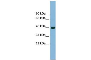WB Suggested Anti-IMPAD1 Antibody Titration:  0. (IMPAD1 anticorps  (N-Term))