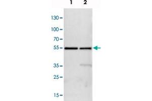 Western blot analysis of Lane 1: NIH-3T3 cell lysate (Mouse embryonic fibroblast cells), Lane 2: NBT-II cell lysate (Rat Wistar bladder tumour cells) with ATP5B polyclonal antibody  at 1:100-1:500 dilution.