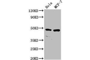 Western Blot Positive WB detected in: Hela whole cell lysate, MCF-7 whole cell lysate All lanes: NSUN5 antibody at 2. (NSUN5 anticorps  (AA 362-466))
