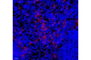 Immunofluorescence of paraffin embedded mouse spleen using IL-27A (ABIN7074367) at dilution of 1: 800 (400x lens)