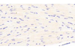 Detection of LAMb1 in Mouse Cardiac Muscle Tissue using Polyclonal Antibody to Laminin Beta 1 (LAMb1) (Laminin beta 1 anticorps  (AA 1053-1258))