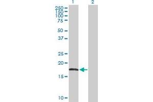Western Blot analysis of AHNAK expression in transfected 293T cell line by AHNAK MaxPab polyclonal antibody. (AHNAK anticorps  (AA 1-149))