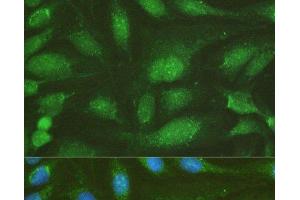 Immunofluorescence analysis of U-2OS cells using NHEJ1 Polyclonal Antibody at dilution of 1:100.