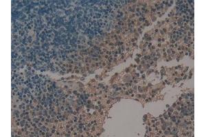Detection of uPA in Mouse Spleen Tissue using Polyclonal Antibody to Plasminogen Activator, Urokinase (uPA) (PLAU anticorps  (AA 180-433))