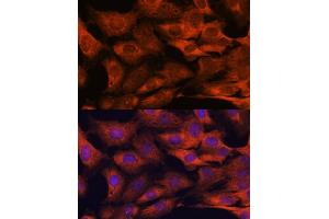 Immunofluorescence analysis of C6 cells using M antibody (ABIN3023031, ABIN3023032, ABIN3023033, ABIN1513170 and ABIN6219356) at dilution of 1:100.