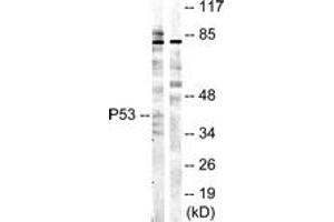 Western blot analysis of extracts from COS7 cells, treated with UV 5', using p53 (Ab-20) Antibody. (p53 anticorps  (AA 10-59))