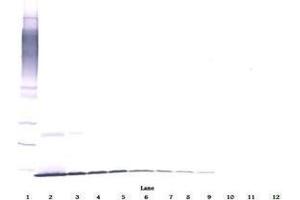 Image no. 3 for anti-Nerve Growth Factor (NGF) antibody (ABIN465644)