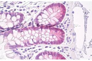 Image no. 1 for anti-Glutathione Peroxidase 2 (GPX2) antibody (ABIN1502290) (Glutathione Peroxidase 2 anticorps)
