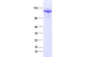 Validation with Western Blot (CTNNB1 Protein (His tag))