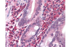 Anti-SLC20A1 antibody IHC of human small intestine.