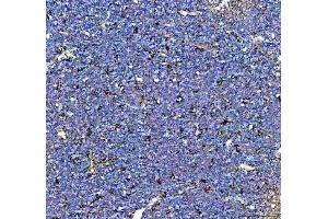 IHC analysis of Cd163 using anti-Cd163 antibody (ABIN7599846).