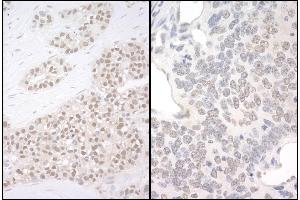 Immunohistochemistry (IHC) image for anti-Polyglutamine Binding Protein 1 (PQBP1) (AA 215-265) antibody (ABIN7453759)