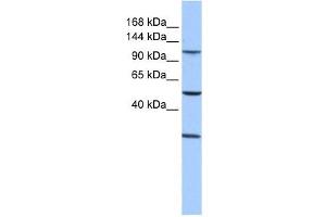 STAG3 antibody used at 1 ug/ml to detect target protein. (STAG3 anticorps  (Middle Region))