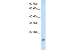 Western Blotting (WB) image for anti-Protein Phosphatase 1, Regulatory Subunit 8 (PPP1R8) antibody (ABIN2462127) (PPP1R8 anticorps)