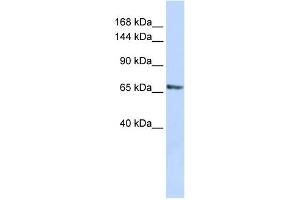 WB Suggested Anti-RBM26 Antibody Titration:  0. (RBM26 anticorps  (Middle Region))