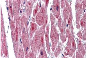 Human Heart: Formalin-Fixed, Paraffin-Embedded (FFPE)