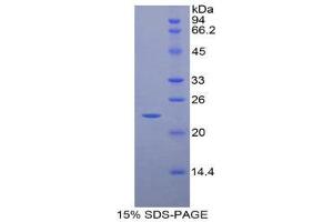 SDS-PAGE (SDS) image for CD8b Molecule (CD8B) (AA 21-208) protein (His tag) (ABIN1879512)