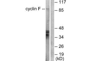 Western blot analysis of extracts from HeLa cells, using Cyclin F antibody (ABIN5976376). (Cyclin F anticorps  (C-Term))