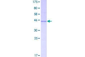 Image no. 1 for MAP Kinase Interacting serine/threonine Kinase 2 (MKNK2) (AA 1-158) protein (GST tag) (ABIN1310978)