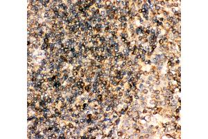 Anti-CD23 Picoband antibody,  IHC(P): Human Tonsil Tissue