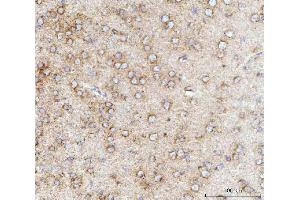 IHC analysis of MFF using anti-MFF antibody (ABIN7599292). (MFF anticorps  (AA 1-342))