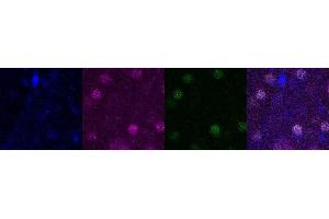Immunohistochemistry (IHC) image for anti-SATB Homeobox 2 (SATB2) antibody (ABIN7456088) (SATB2 anticorps)