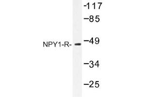 Image no. 1 for anti-Neuropeptide Y Receptor 1 (NPY1R) antibody (ABIN317656) (NPY1R anticorps)