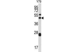 Western Blotting (WB) image for anti-Actin Related Protein 2/3 Complex, Subunit 1A, 41kDa (ARPC1A) antibody (ABIN3002660) (ARPC1A anticorps)