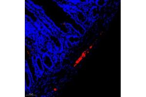 Immunofluorescent analysis of paraffin embedded rat colon using peripherin (ABIN7075012) at dilution of 1: 1600