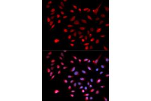 Immunofluorescence analysis of U2OS cells using CDK9 antibody (ABIN5970745). (CDK9 anticorps)