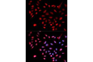 Immunofluorescence analysis of U2OS cells using CDK9 antibody (ABIN5970745). (CDK9 anticorps)