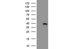 Western Blotting (WB) image for anti-Myeloid Leukemia Factor 1 (MLF1) antibody (ABIN1499496) (MLF1 anticorps)