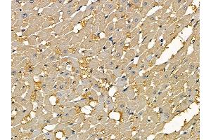 ABIN7095389 and ABIN7099446 at 1/100 staining rat heart tissue by IHC-P.