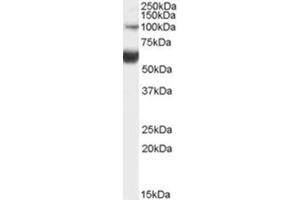 Image no. 1 for anti-HNF1 Homeobox B (HNF1B) (Internal Region) antibody (ABIN375249) (HNF1B anticorps  (Internal Region))
